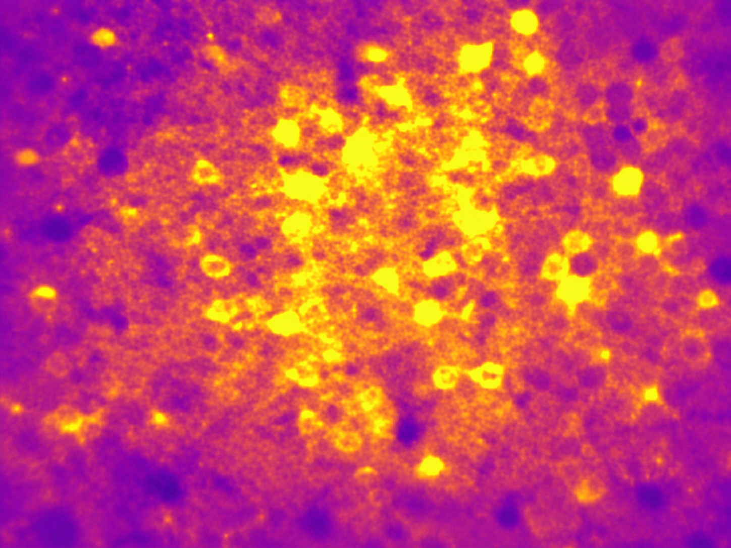 Two-photon calcium imaging data used for self-supervised denoising